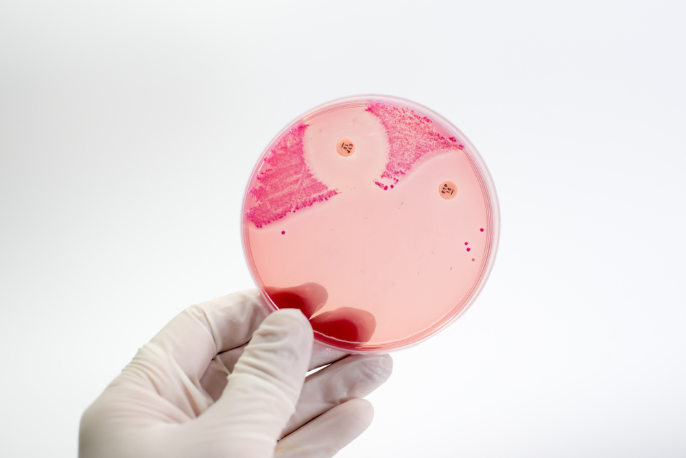CRE resistance, Image credit NonSitth via Shutterstock.