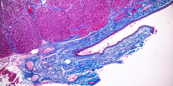 Liver cells under a microscope. Image credit: Adobe Stock. 