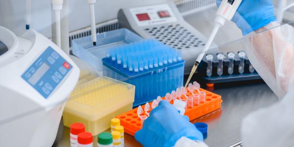 A scientist using a pipette. VIROMARKERS is studying viral infections HIV, hepatitis and CMV.
