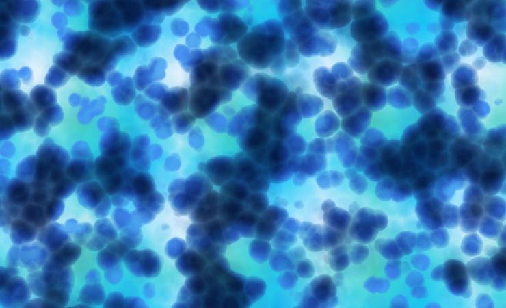 Cancer cells under microscope. Image credit: BORIS via Adobe Stock.