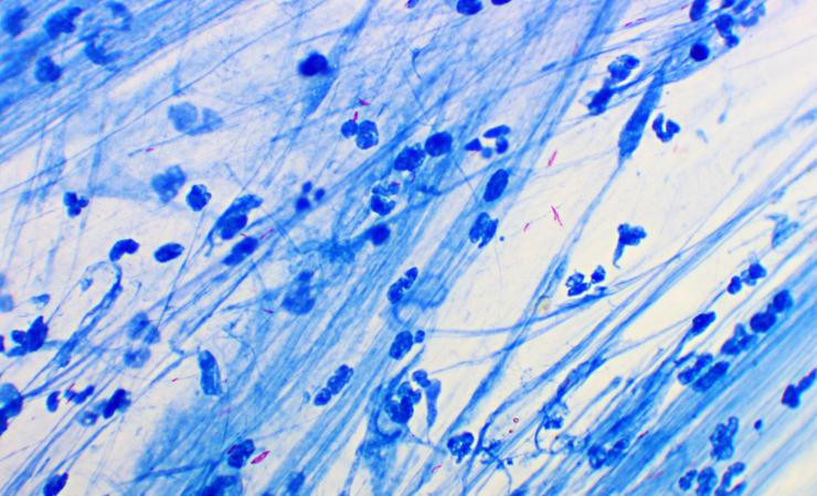 Mycobacterium tuberculosis. Image credit Jarun Ontakrai via Shutterstock