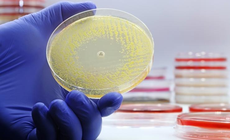 A gloved hand holding a petri dish with bacteria. END2AMR is tackling antimicrobial resistance (AMR).