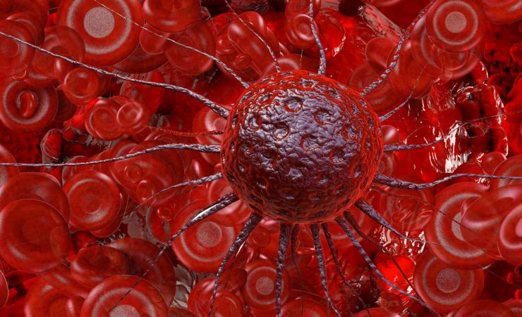 Cancer cell in blood. Image by xrender via Shutterstock