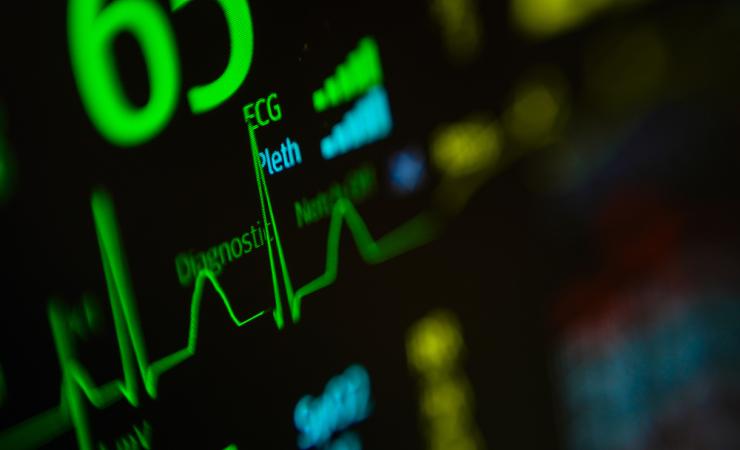 An ECG screen. EuroHeartPath aims to improve the care of people with cardiovascular diseases.