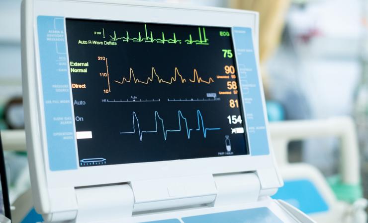 An EKG machine, symbolising the kind of health data that exists on cardiovascular disease patients