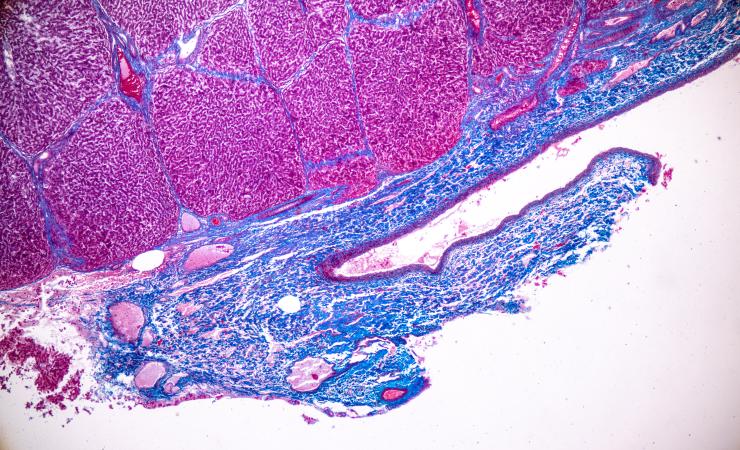 Liver cells seen through microscope. Image credit: Adobe Stock. 