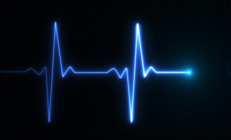 A blue ECG line on a black background. The care pathway for cardiovascular diseases is complex.