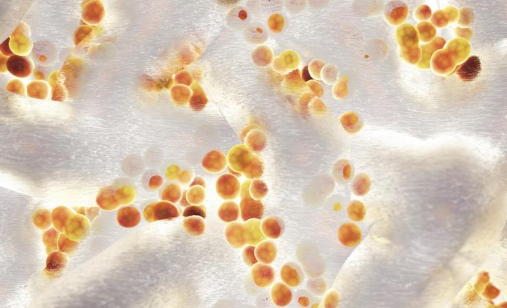 3D image of a S.aureus colony, a bacteria that can cause serious infections and is often resistant to treatments. Image credit: nobeastsofierce via Shutterstock. 