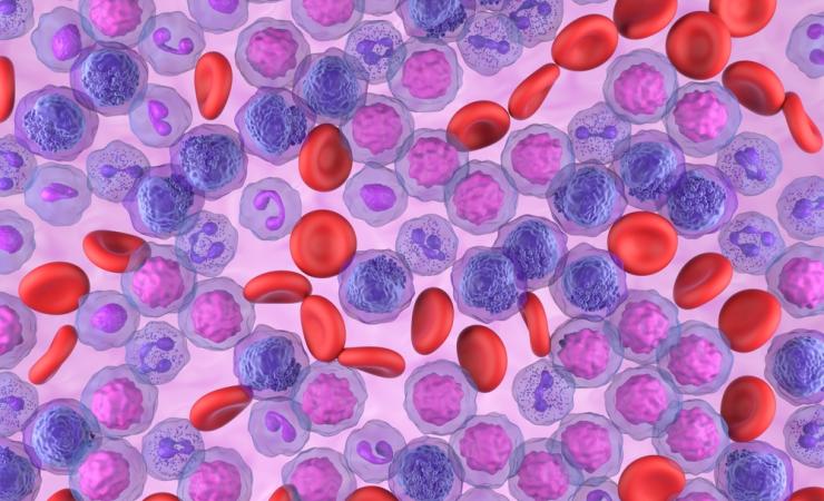 Acute Myeloid Leukemia cells in 3D illustration. Image by Nemes Laszlo via Shutterstock