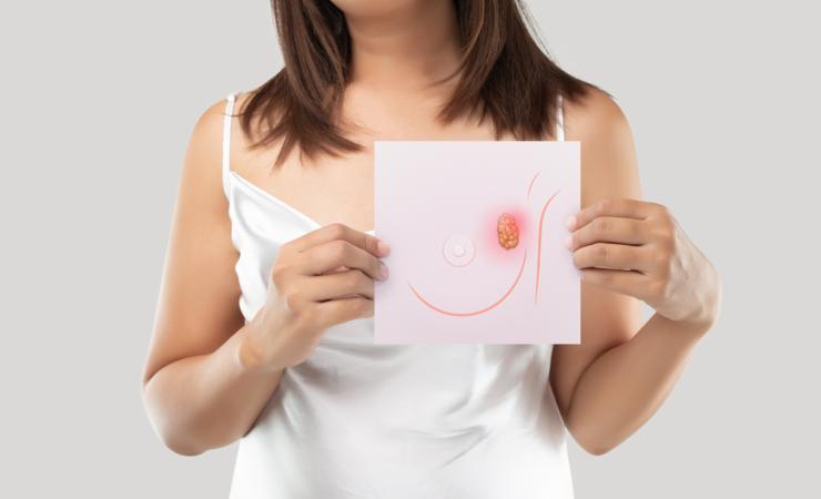 Breast cancer image by Emily frost via Shutterstock
