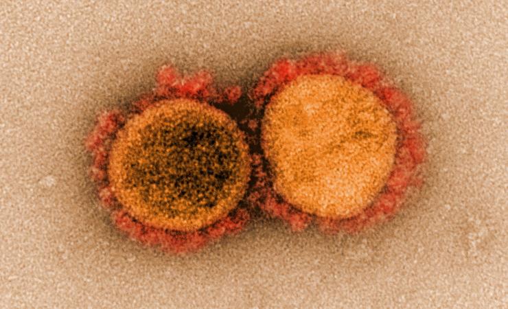 Transmission electron micrograph of SARS-CoV-2 virus particles. Image by National Institute of Allergy and Infectious Diseases, NIH
