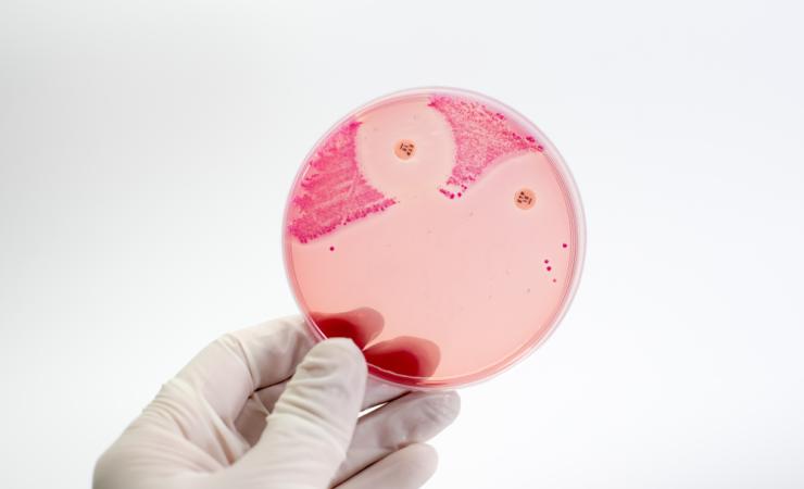 CRE-resistant bacteria in a petri dish. Credit: Non Sitth via Shutterstock.