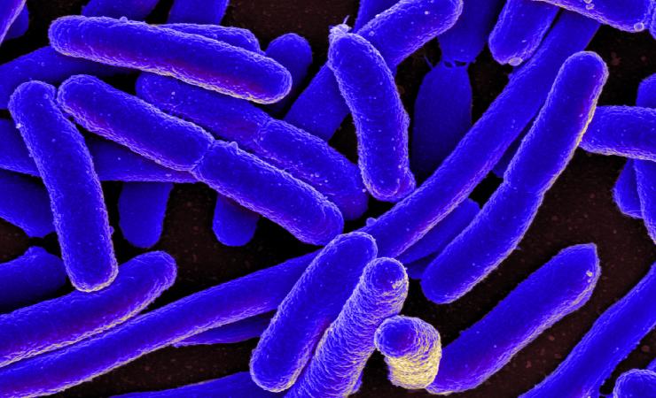 A scanning electron micrograph of Escherichia coli - the bacteria appear blue against a dark background.