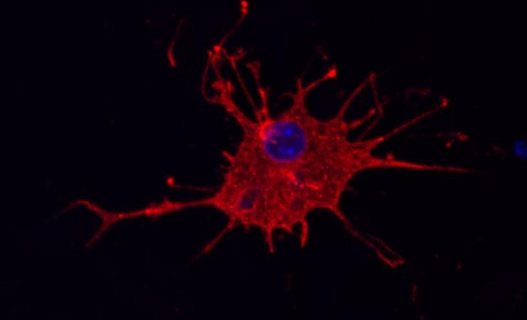 Human microglia. Image courtesy of Life and Brain