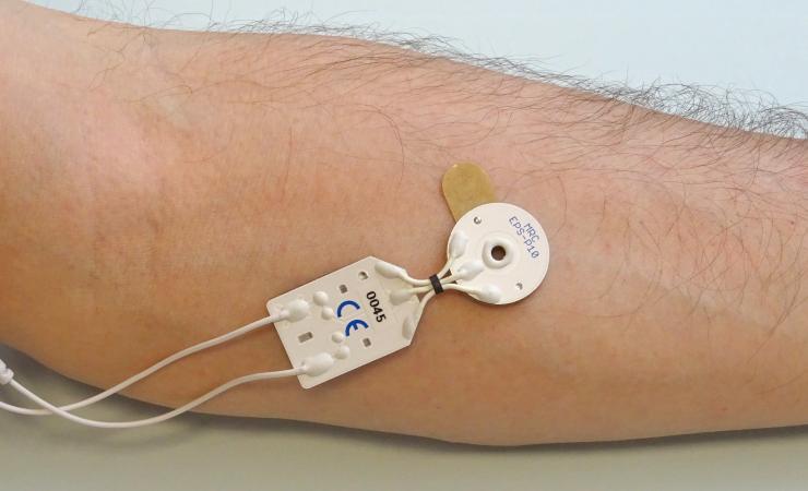 A white electrode is attached to the inside of a person's forearm. There are two white wires coming out of the device. Image credit: Jan Niclas Hoeink, MRC Systems GmbH