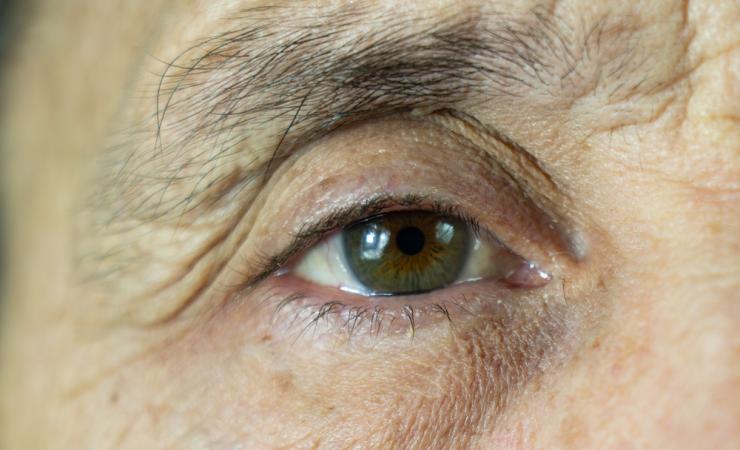 A close-up of the eye of an older man. Image by woff via Shutterstock