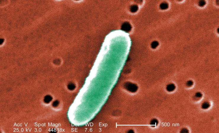 Some bacteria, like E. coli, have found a way to survive treatment with carbapenem antibiotics. Image by Everett Collection via Shutterstock E.coli bacteria. Image by Everett Collection via Shutterstock