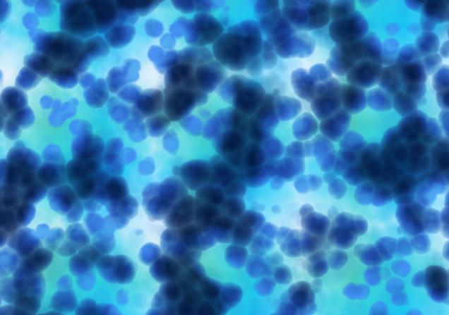 Cancer cells under microscope. Image credit: BORIS via Adobe Stock.