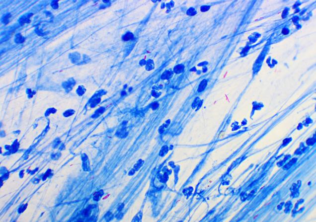 Mycobacterium tuberculosis. Image credit Jarun Ontakrai via Shutterstock 