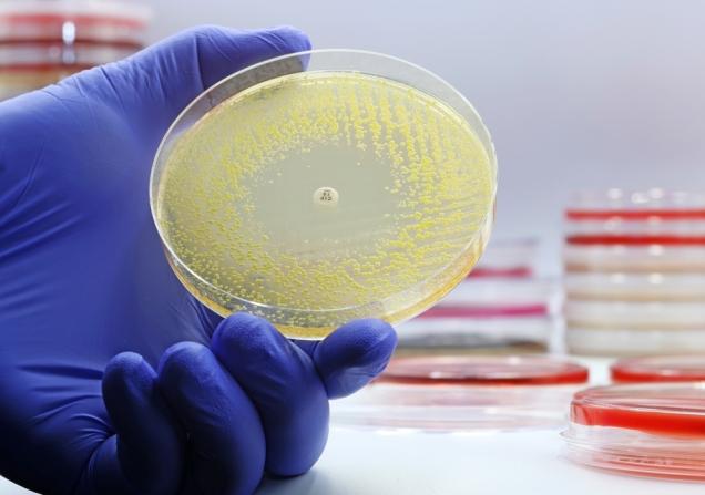 A gloved hand holding a petri dish with bacteria. END2AMR is tackling antimicrobial resistance (AMR). © TopMicrobialStock, Shutterstock