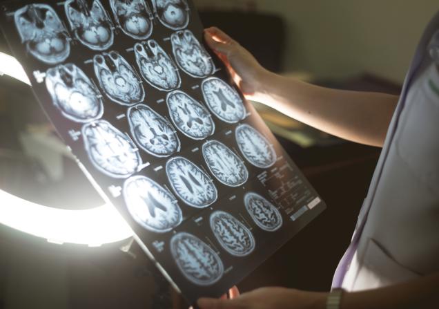 Researcher looking at a brain scan. Image credit: Atthapon Raksthaput