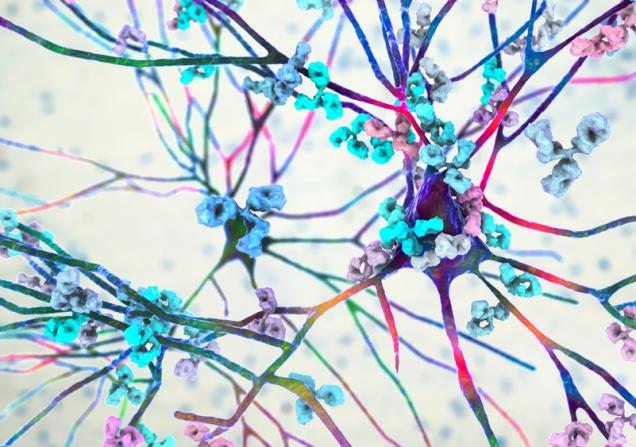 Lupus may affect any organ of the body. Here a brain cell is being attacked by the body's own antibodies. Image credit: Kataryna Kon via Shutterstock.