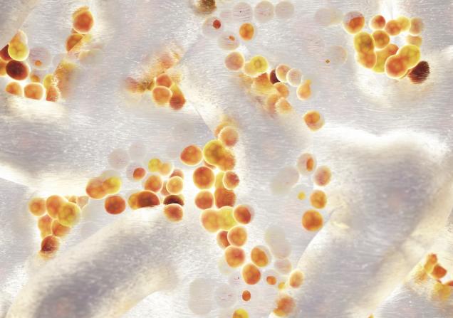 3D image of a S.aureus colony, a bacteria that can cause serious infections and is often resistant to treatments. Image credit: nobeastsofierce via Shutterstock.