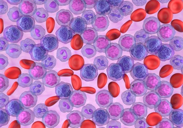 Acute Myeloid Leukemia cells in 3D illustration. Image by Nemes Laszlo via Shutterstock