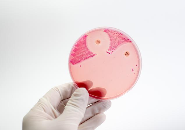 CRE-resistant bacteria in a petri dish. Credit: Non Sitth via Shutterstock.