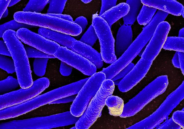 A scanning electron micrograph of Escherichia coli - the bacteria appear blue against a dark background. Image by National Institute of Allergy and Infectious Diseases, National Institutes of Health