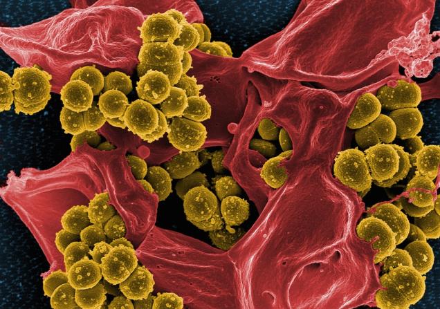 SEM image of MRSA. Image credit: Image Source Trading Ltd via Shutterstock.