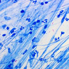 Mycobacterium tuberculosis. Image credit Jarun Ontakrai via Shutterstock