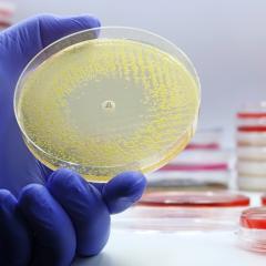 A gloved hand holding a petri dish with bacteria. END2AMR is tackling antimicrobial resistance (AMR).