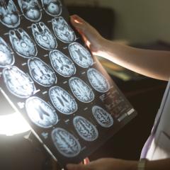 Researcher looking at a brain scane. Image credit: Atthapon Raksthaput