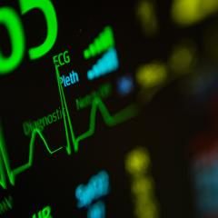 An ECG screen. EuroHeartPath aims to improve the care of people with cardiovascular diseases.