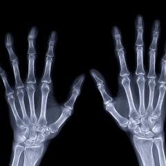 Image by Radiological Imaging via Shutterstock. An x-ray of a pair of hands. Image by Radiological Imaging via Shutterstock.