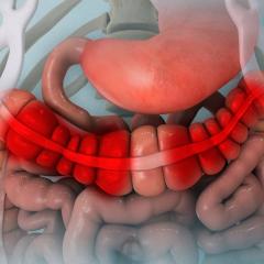 Inflammatory bowel disease. Image credit: Nathan Devery via Shutterstock.