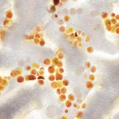 3D image of a S.aureus colony, a bacteria that can cause serious infections and is often resistant to treatments. Image credit: nobeastsofierce via Shutterstock. 3D image of a S.aureus colony, a bacteria that can cause serious infections and is often resistant to treatments. Image credit: nobeastsofierce via Shutterstock.