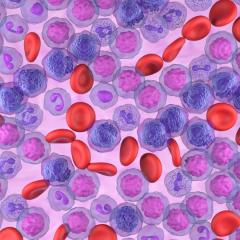 Acute Myeloid Leukemia cells in 3D illustration. Image by Nemes Laszlo via Shutterstock