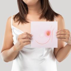 Breast cancer image by Emily frost via Shutterstock