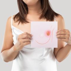 iCoCs can be tailor-made to answer specific questions, and they do a really good job of replicating the tumour microenvironment. Image by Emily Frost via Shutterstock. Breast cancer image by Emily frost via Shutterstock