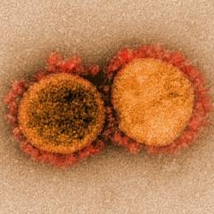 Transmission electron micrograph of SARS-CoV-2 virus particles. Image by National Institute of Allergy and Infectious Diseases, NIH