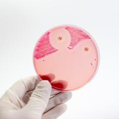 CRE-resistant bacteria in a petri dish. Credit: Non Sitth via Shutterstock.