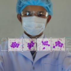 Doctor looking at leukemia cells by T-Photo via Shutterstock