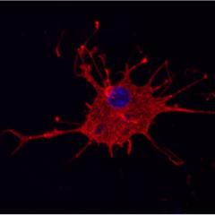 Human microglia. Image courtesy of Life and Brain