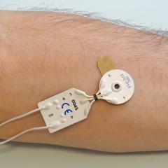 A white electrode is attached to the inside of a person's forearm. There are two white wires coming out of the device. Image credit: Jan Niclas Hoeink, MRC Systems GmbH