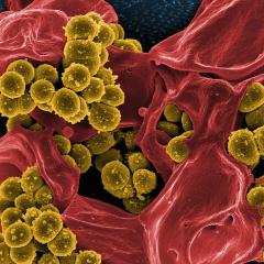 SEM image of MRSA. Image credit: Image Source Trading Ltd via Shutterstock. 