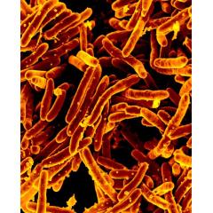 Scanning electron micrograph of Mycobacterium tuberculosis bacteria, which cause TB. Image by National Institute of Allergy and Infectious Diseases, National Institutes of Health