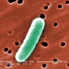 E.coli bacteria. Image by Everett Collection via Shutterstock